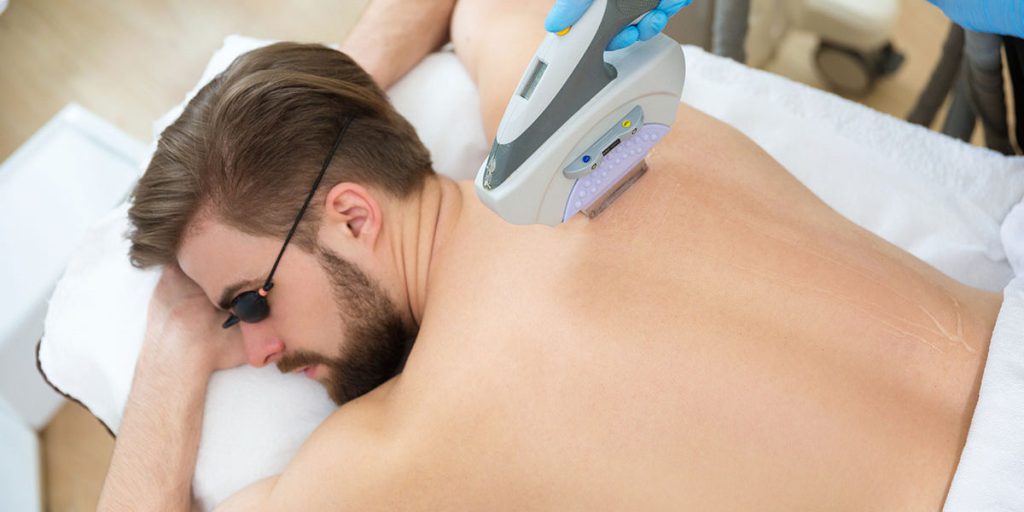 Laser Hair Removal Process